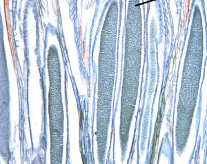 <p>ploidy of area referenced by arrow?</p>