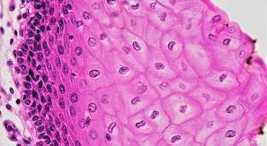 <p>What tissue type is this?</p>