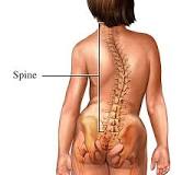 a spinal curve more than 20 degrees
