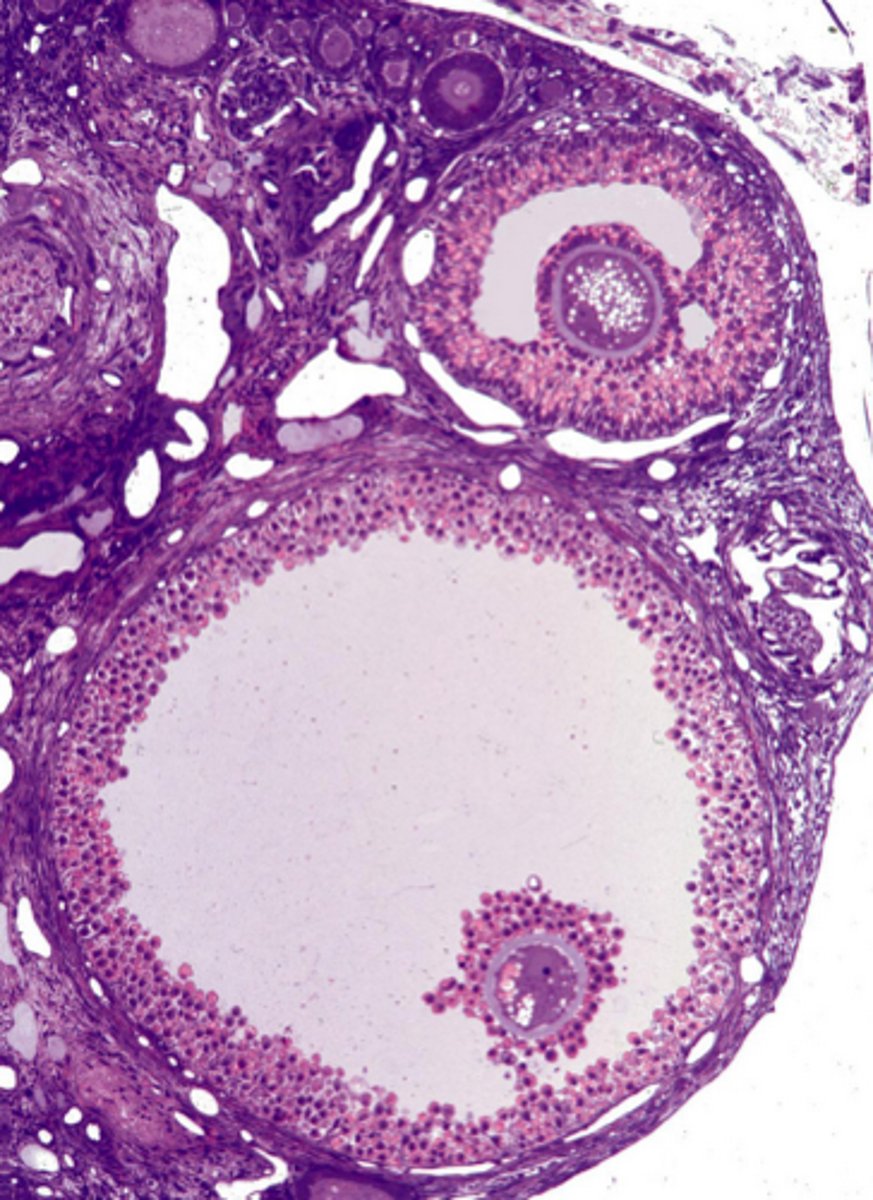 <p>ID the ovarian cell stage:</p>