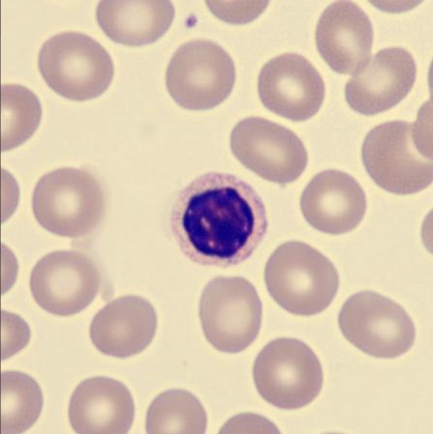 <p>What is this neutrophil showing?</p>