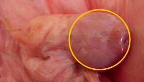 <p>Corpus luteum or follicles?</p>