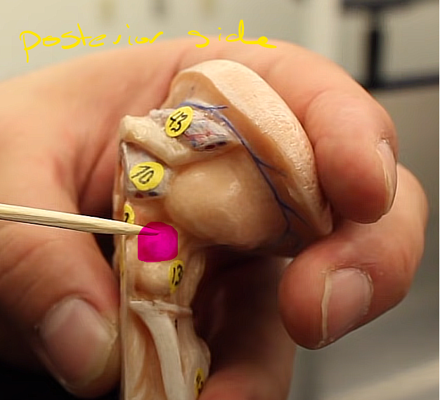 <p>brainstem organization pg.~458</p><p>what is this structure of the midbrain</p>