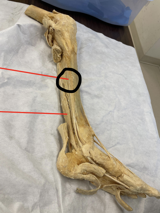 <p>identify + state origin, insertion, action, innervation of marked structure</p>