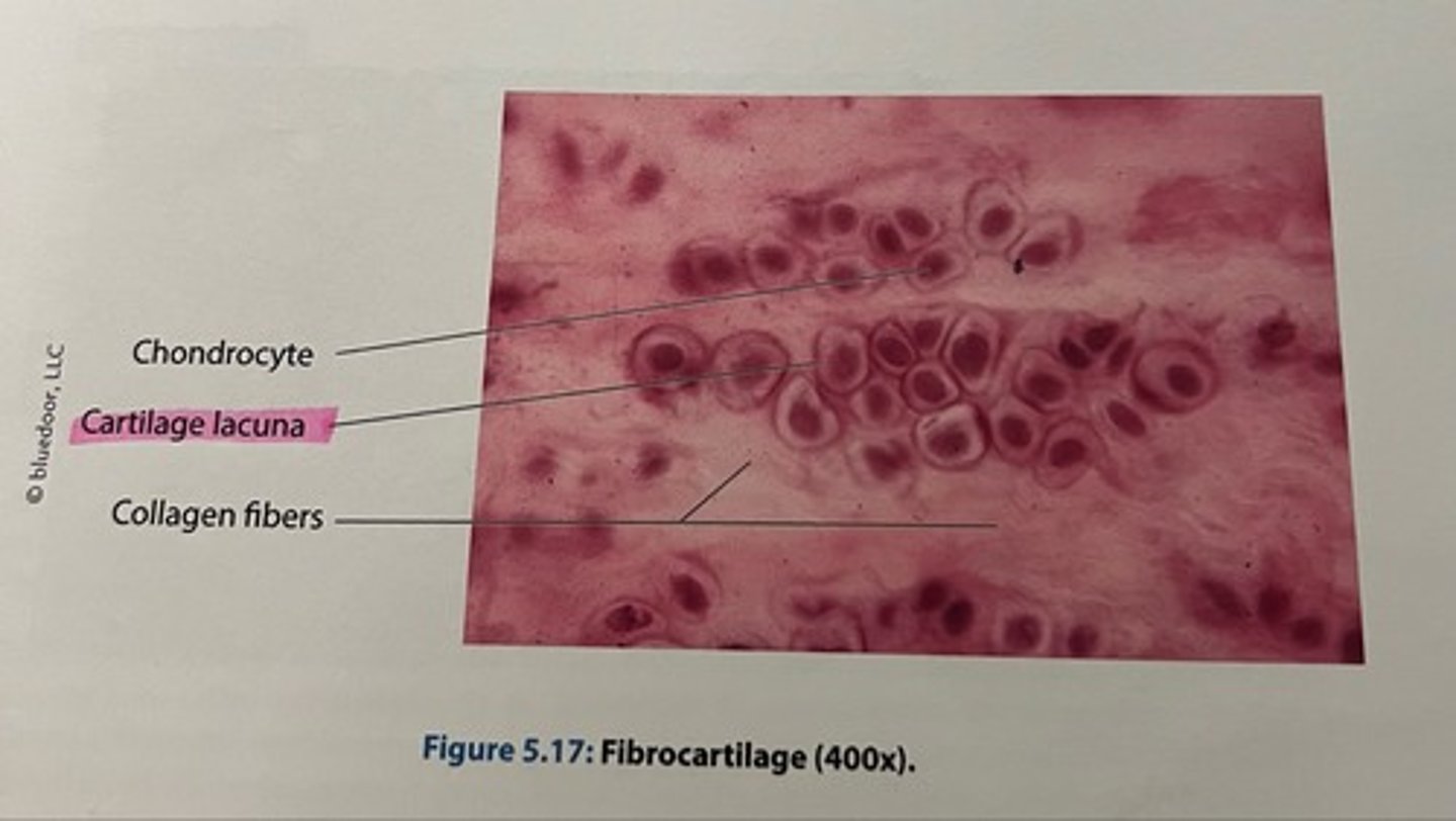 <p>Locations: pubic symphysis, menisci, and intervertebral discs</p><p>•Functions</p><p>•Resists compression</p><p>•Absorbs shock</p>