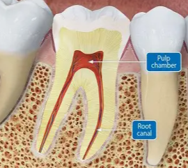 <p>The space inside the tooth root that holds nerves and blood vessels.</p>