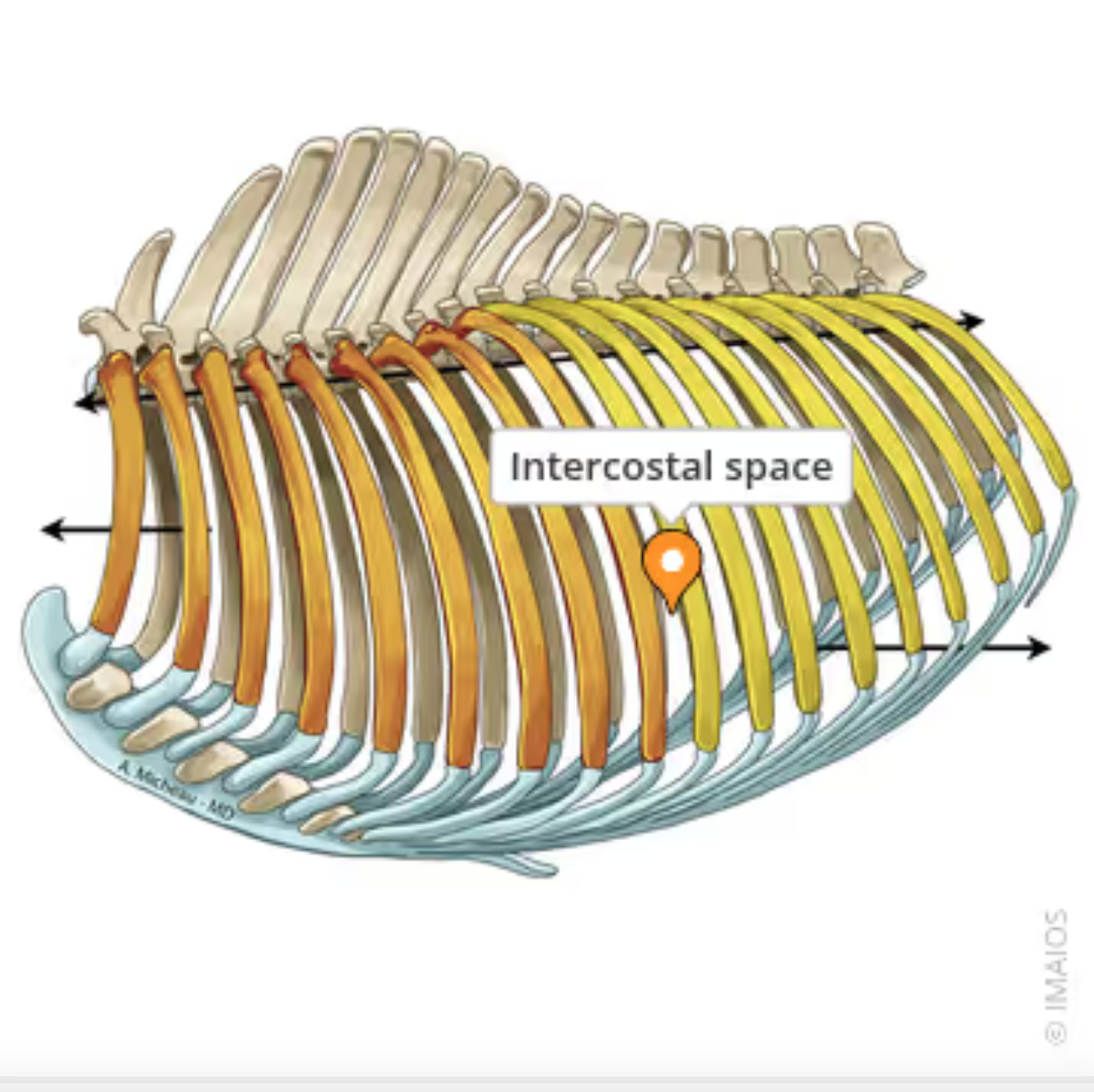<p>The anatomical area between two adjacent ribs housing intercostal muscles, blood vessels and nerves. Crucial for respiration and surgical access. Utilized for various veterinary procedures including exploration of the thoracic cavity, managing thoracic diseases, performing thoracic surgeries like intercostal thoracotomy and in diagnostic imaging such as ultrasound examinations. </p>