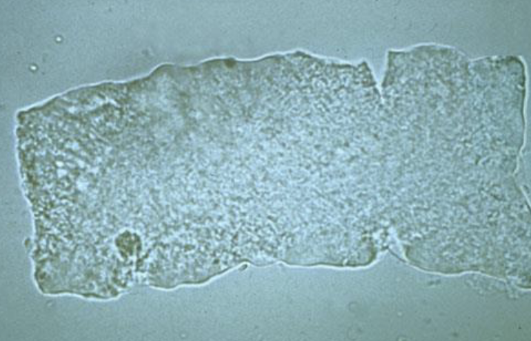 <p>What type of cast is this?</p><p>When would you see these?</p>