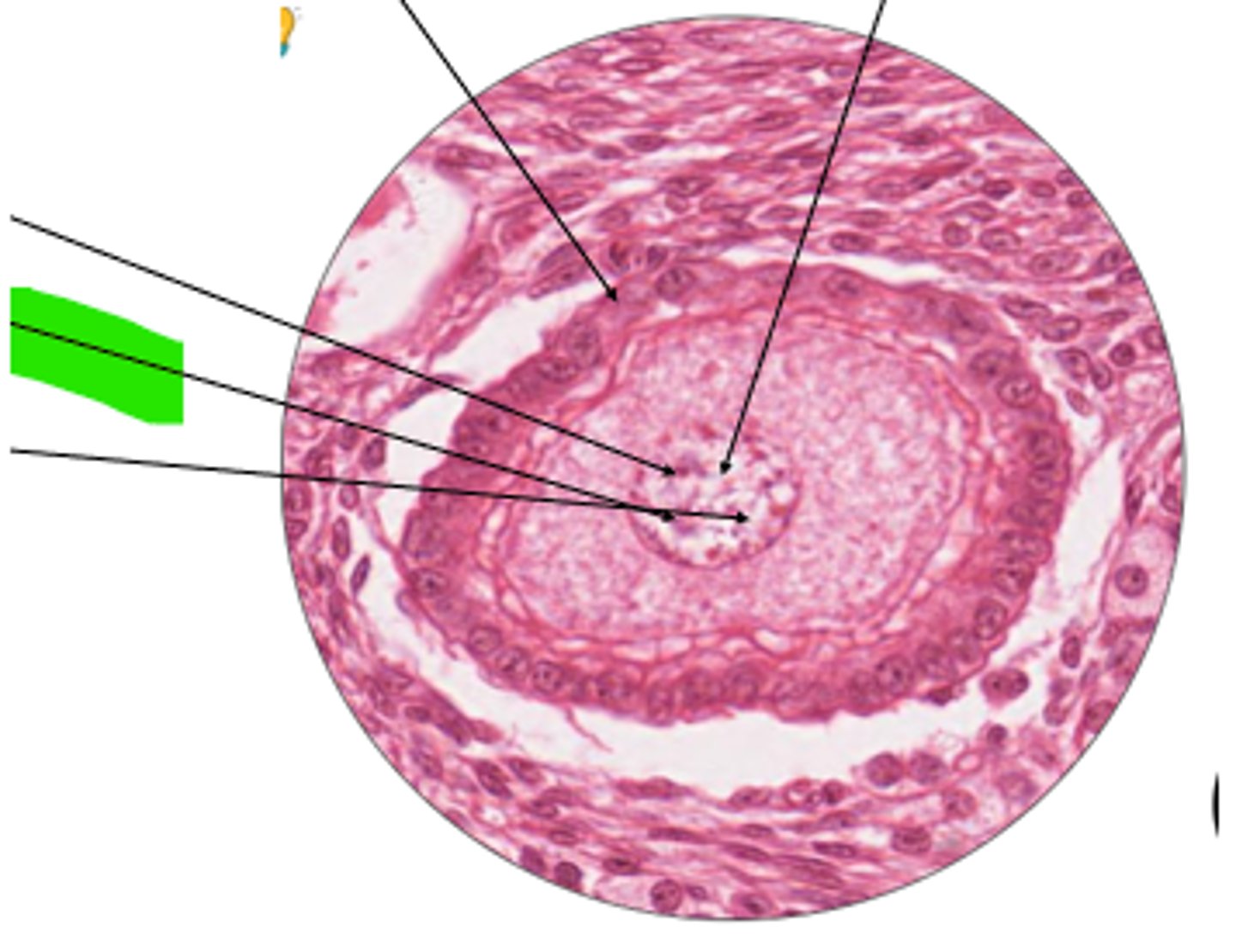 <p>part of tertiary follicle?</p>