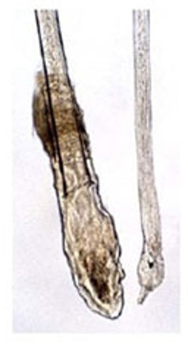 <p>In welke fase van de groei zit dit haar?</p><p>- clubvormige bulbus</p><p>- niet gepigmenteerd, volledig gekeratiniseerd</p><p>- al dan niet met epitheliale zak</p>