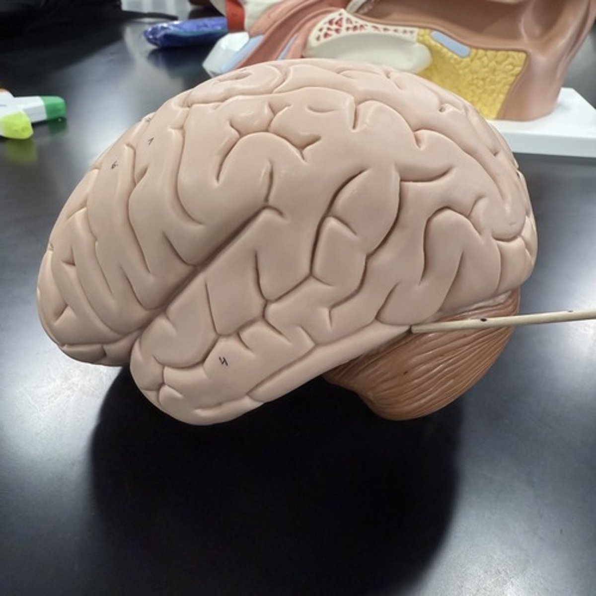 <p>What is this deep groove?</p>