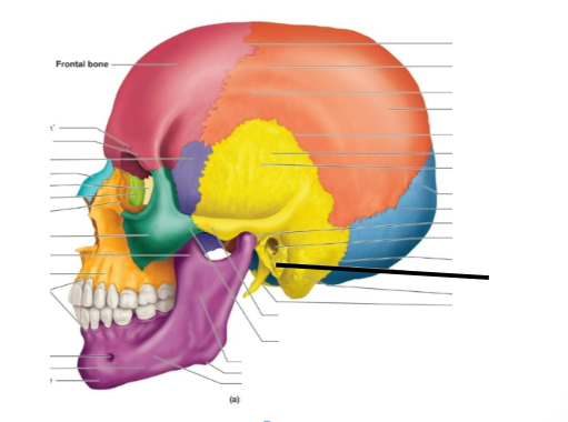 term image