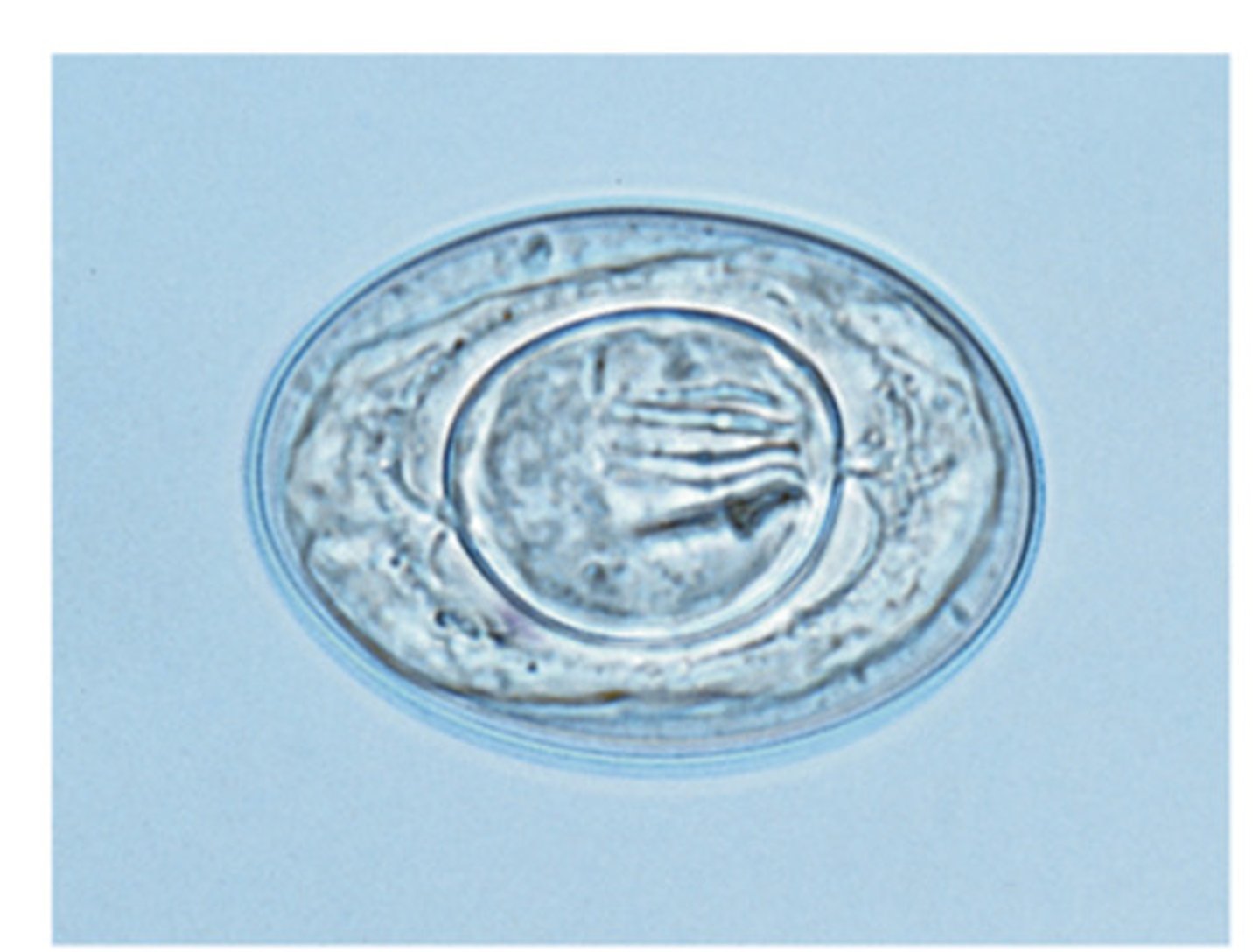 <p>This ovum, of a eucestoda species, is 62 um '30-55 um and oval in shape. The definitive hosts of this Cestode include mice, rats, dogs, and humans. The genus and species of this rodent Cestode is</p>