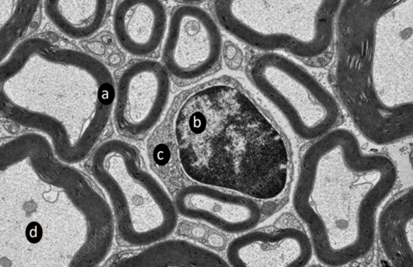 <p>d: two structures present in labelled region</p>