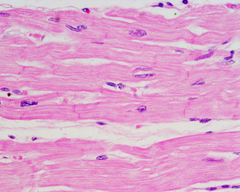 <p>The cells of the muscular tissue are long and thin; however, the three types of muscle tissue have a variation in what they look like. For example, the skeletal and cardiac muscle tissues have stripes across the fibers. Example: Biceps</p>