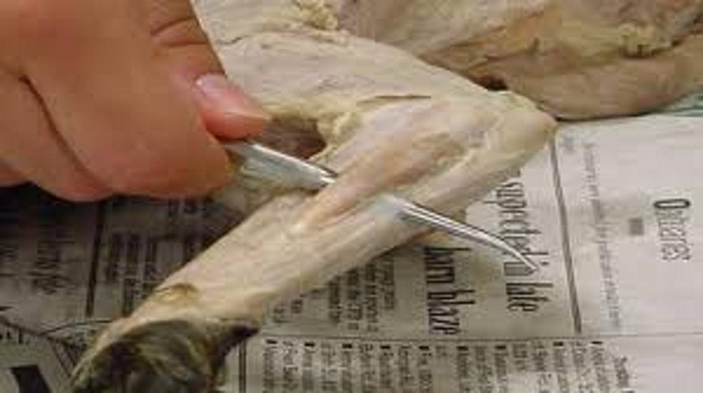 <p>Origin: humerus</p><p>Insertion: radius</p><p>Action: flexes forearm</p>