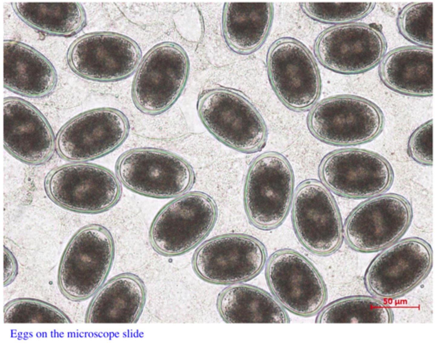 <p>Station 5:</p><p>Eggs like those shown on the microscope slide were found in the faeces (floatation) of 6 month old chooks reared on the floor in an indoor farm. The birds do not show any clinical signs. Identify the parasite</p>