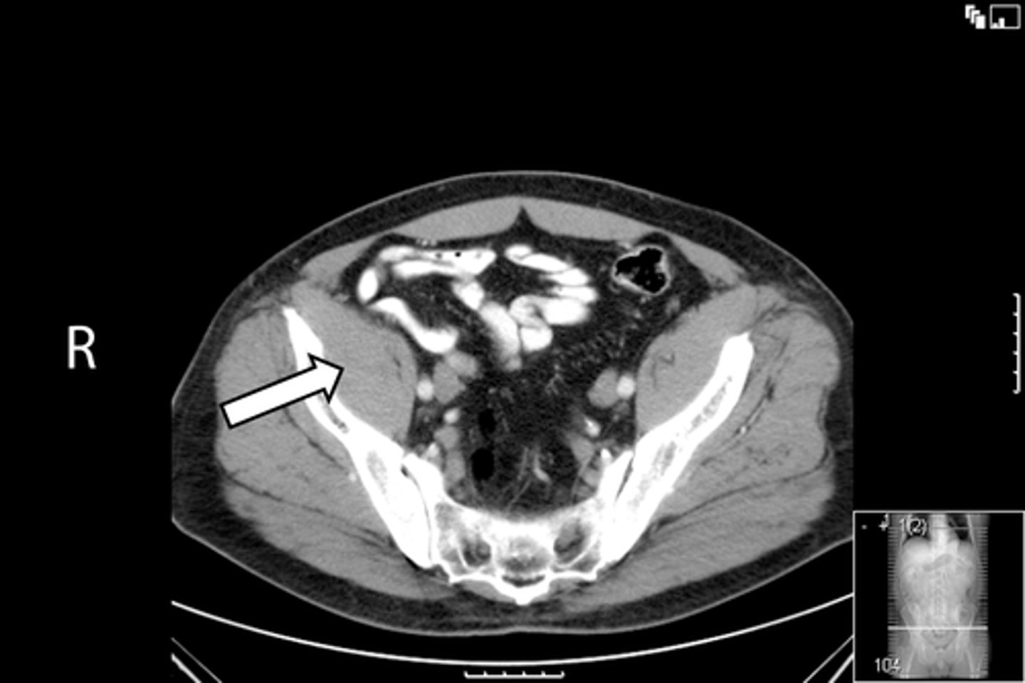 <p>What is indicated in the image?</p>