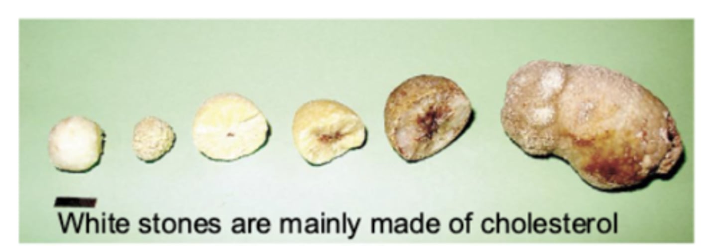 <p>cholesterol (70%)</p>