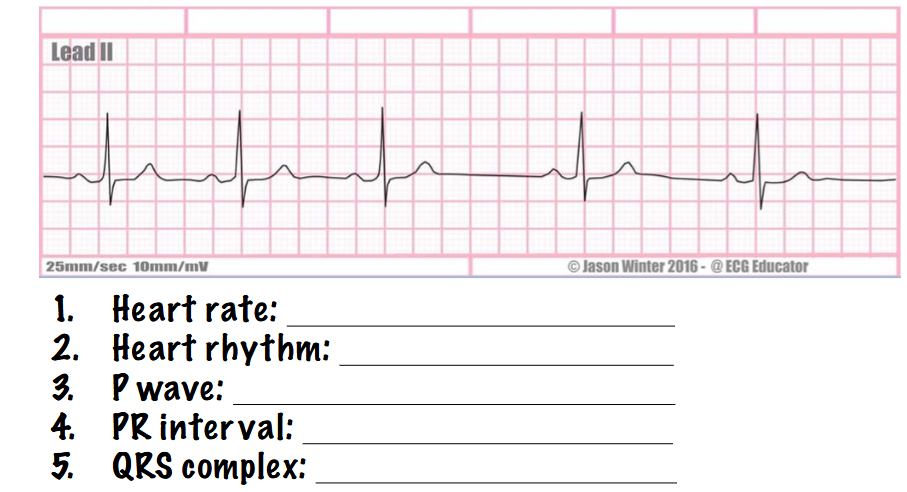 <p>what type of rhythm is this? answer the questions</p>