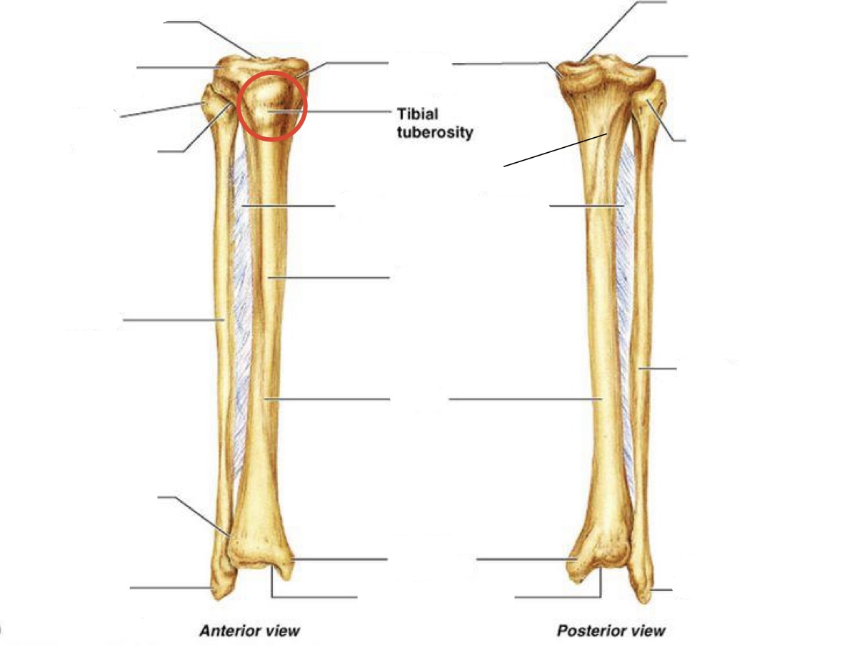 <p><span><span>Tibial tuberosity</span></span></p>