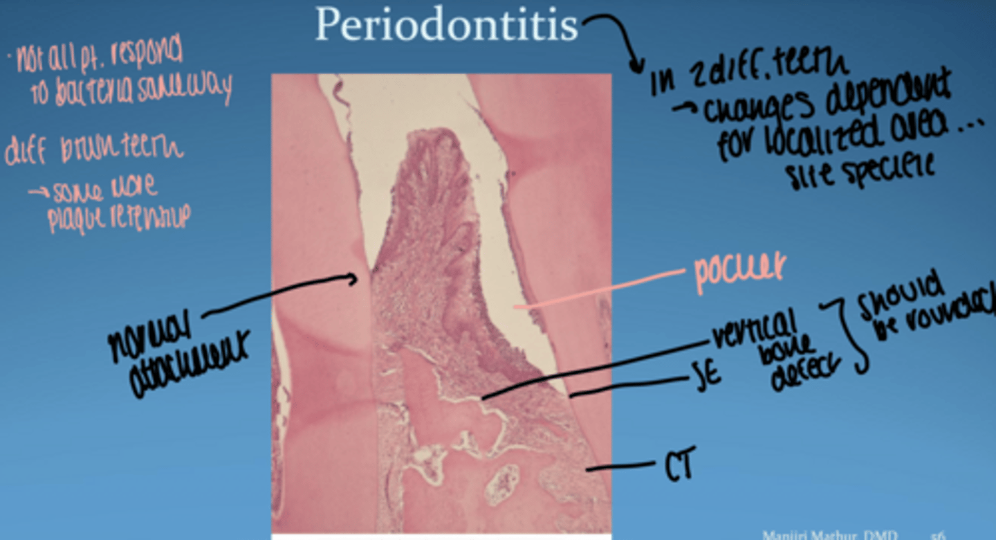 <p>-- in 2 diff teeth.. changes are dependent for localized area (site specific)</p><p>-- not all pt respond to bacteria same way</p>