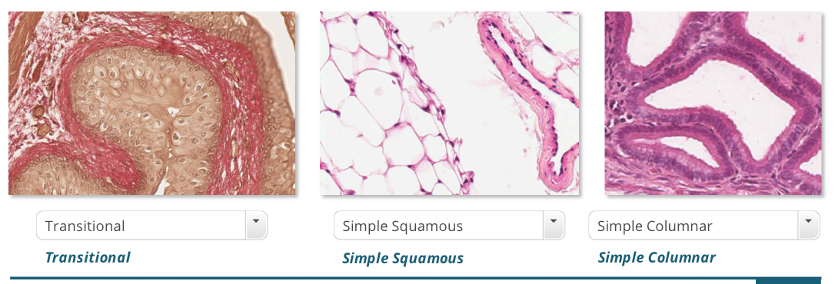 Different types of epithelium