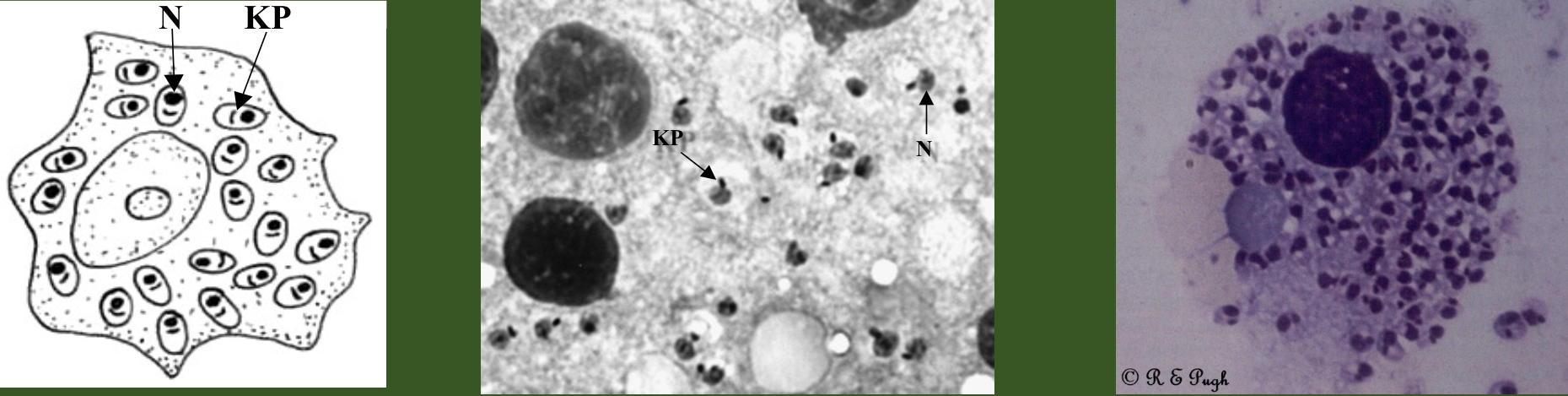 <p>What parasite is this?</p>