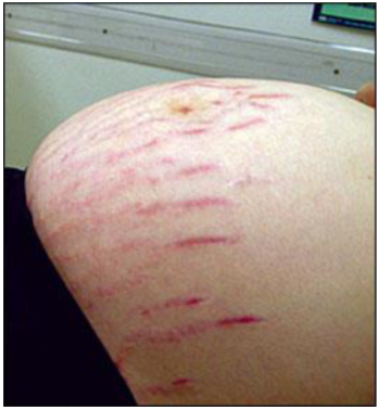 <p>What’s this called</p>