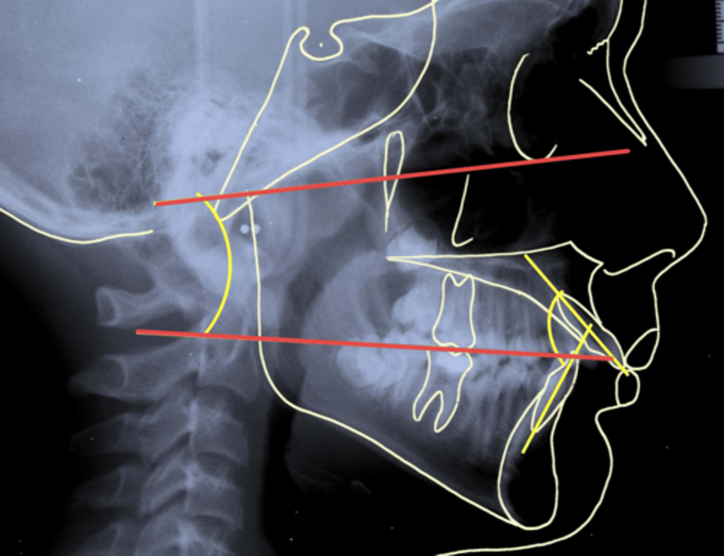 <p>ID the measurement being taken by the red lines:</p>