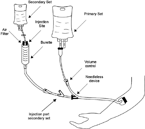 <p>intravenous piggyback</p>