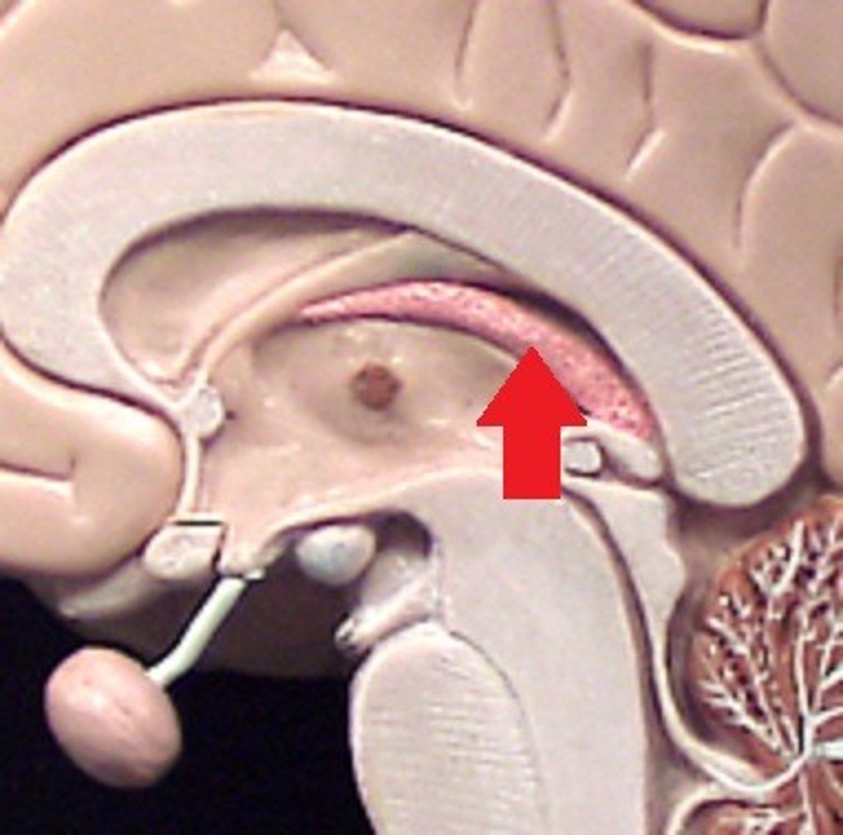 <p>choroid plexus</p>