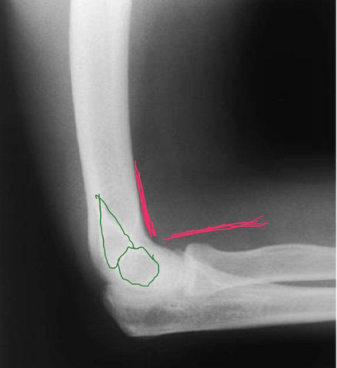 <p>What view does this show?</p>