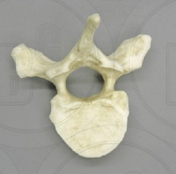 <p>Which Vertebrae is this? </p>