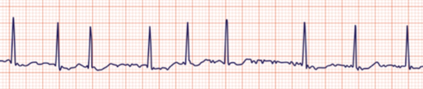 <p>Name the rhythm</p>