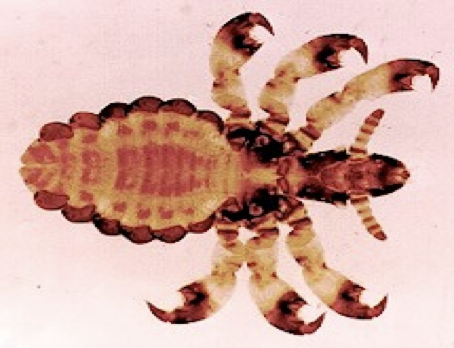 <p>what kind of lice</p>