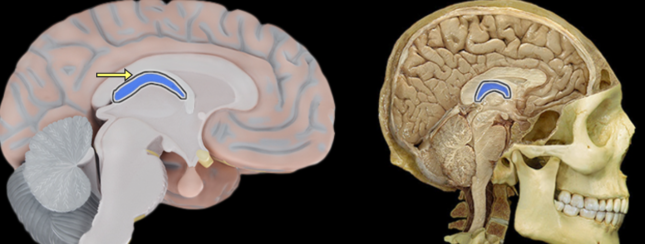 <p>Choroid plexus</p>