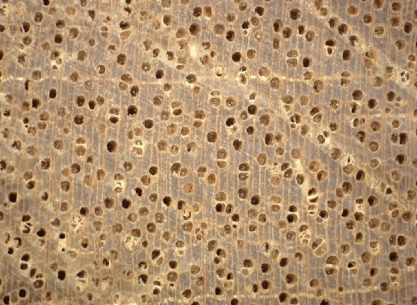 <p>Wood grayish with pinkish tinge; moderately large pore size; pores moderately small, rounded in shape; diffuse in aggregates, vasicentric, and aliform parenchyma; with concentric resin ducts; presence of tyloses</p>