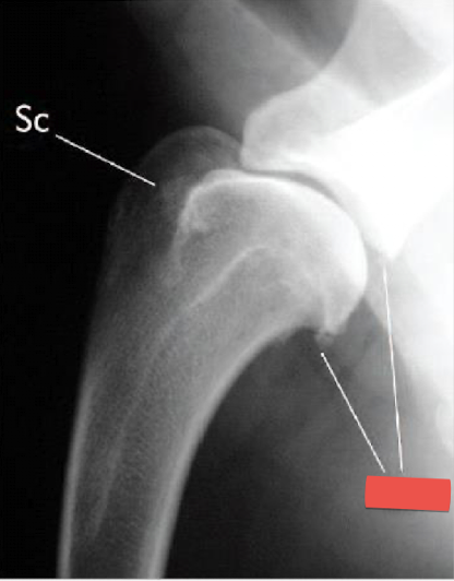 <p>Wha condition is this image depicting? What is the red label showing? </p>