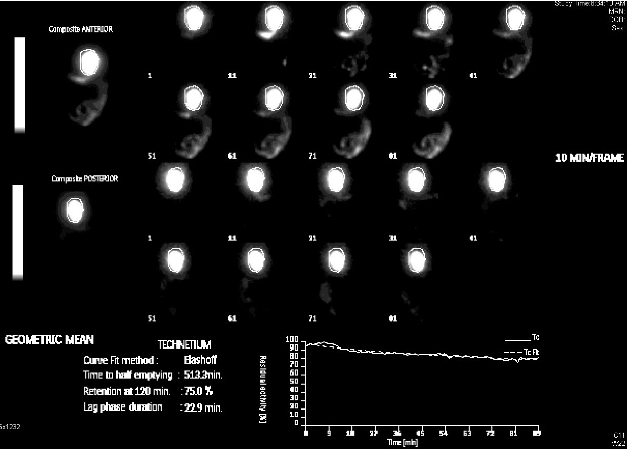 <p>what is this picture showing?</p>