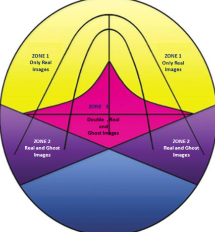 <p>posterior part of the focal trough; real and ghost image </p>