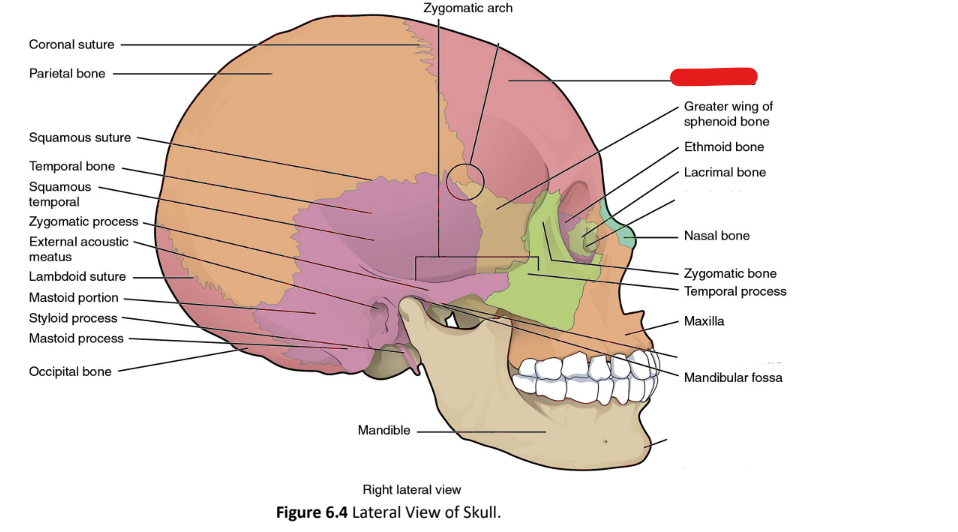 term image