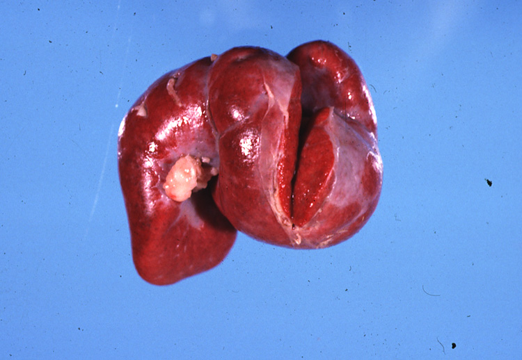 <p>Enlargement and contortion of a feline spleen, both secondary to a mast cell tumor.&nbsp; Which pathology is most likely?</p>
