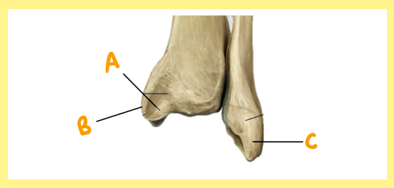 <p><u>Name the following</u>:</p><ul><li><p>Bone?</p></li><li><p>Side?</p></li><li><p>View?</p></li><li><p>C?</p></li></ul><p></p>