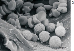 <p>An electron microscope used to study the fine details of cell surfaces.</p>