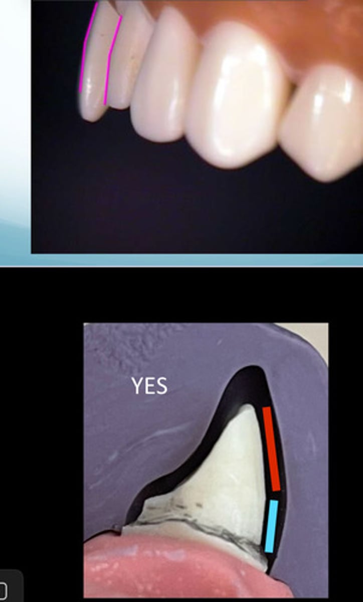 <p>The facial reduction you must follow the</p>