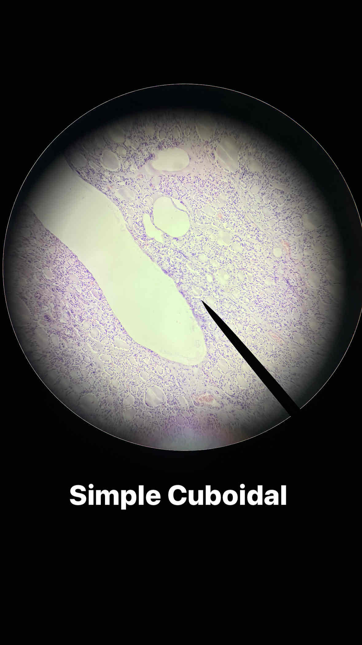 <p><span>type and subtype of tissue?</span></p>