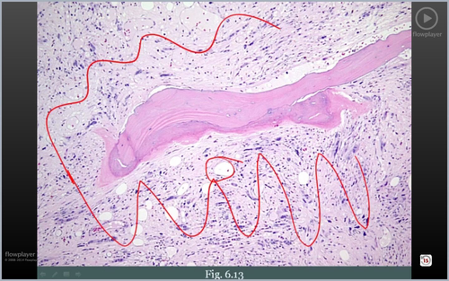<p>BM</p>
