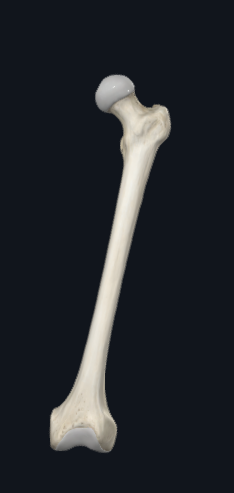 <p>What bone is this? and which side?</p>