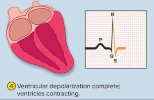 <p>QRS complex</p>